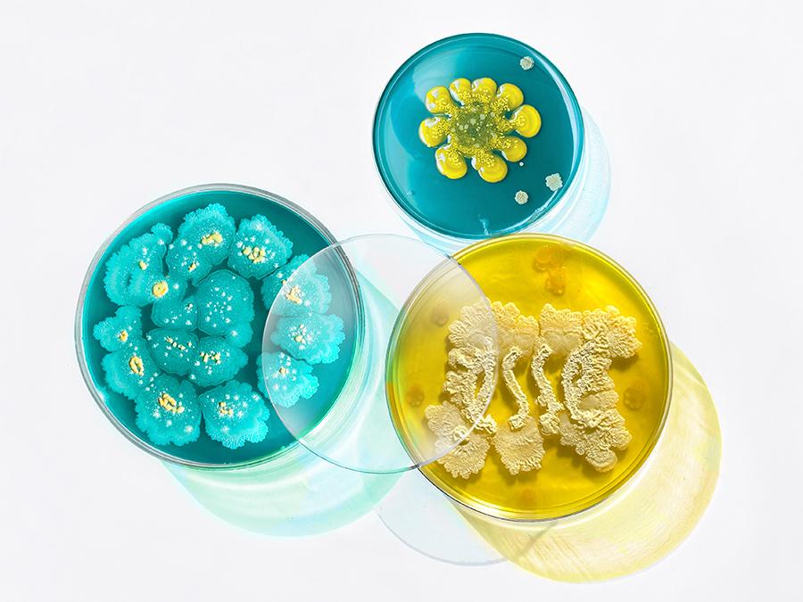 Three petri dishes with colorful bacterial cultures. The top right dish has a yellow flower-like pattern in blue medium, the top left dish has white and teal clusters, and the bottom right dish has intricate beige and white formations in a yellow medium.