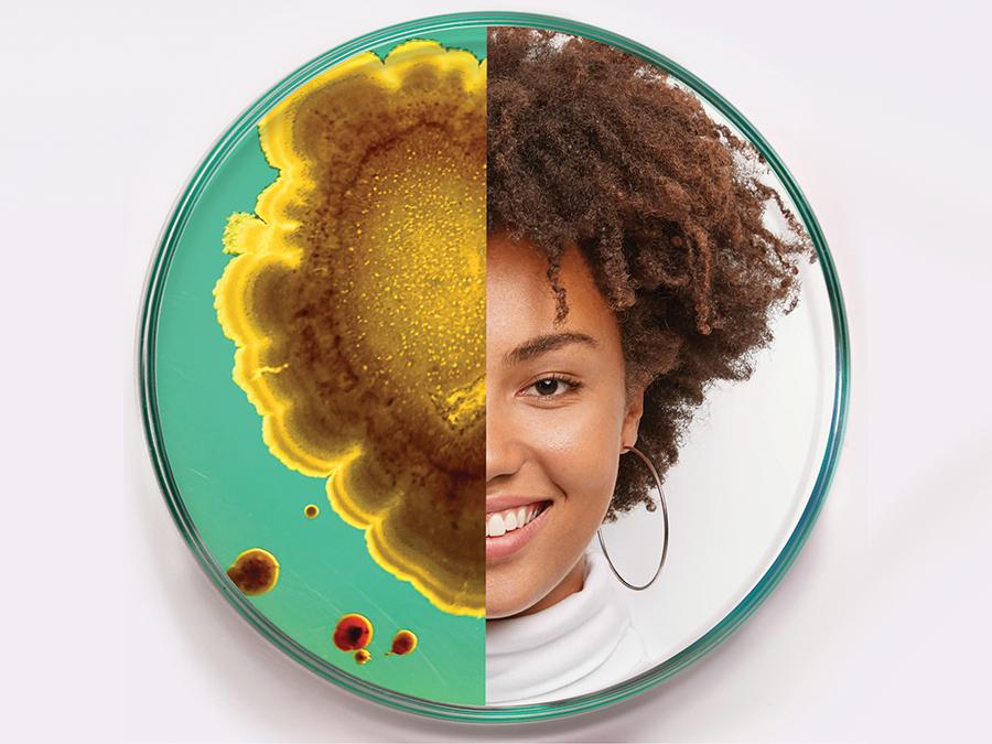 A round dish is split in half. The left side shows a close-up of a yellow and brown bacterial colony on a teal background. The right side shows a smiling woman with curly hair, wearing a white turtleneck and hoop earrings on a plain backdrop.
